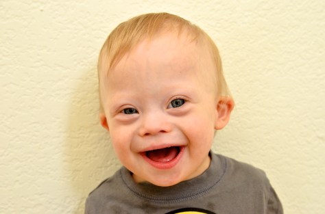 baby-down-syndrome-face-boy-smiling-9